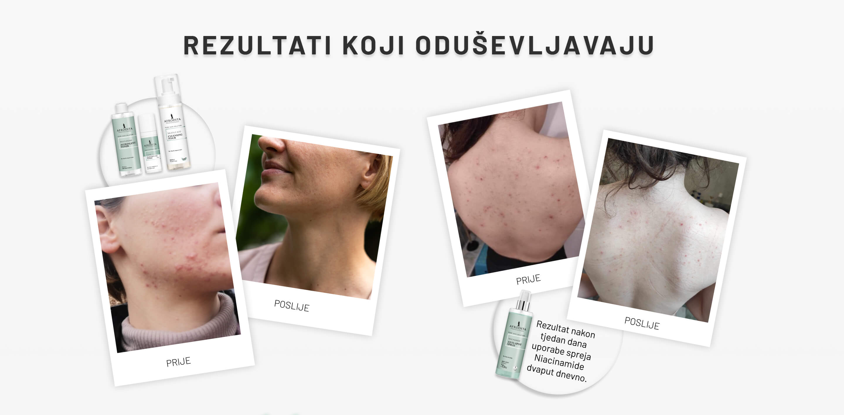 AFRODITA PROFESSIONALPURE-SKIN-Zno-cream_