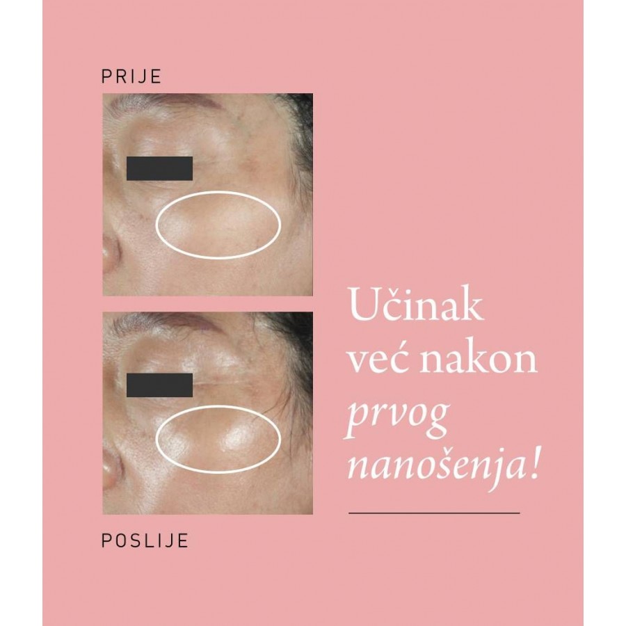 AFRODITA PROFESSIONAL GLOW SHOT ZA SJAJAN IZGLED KOZE